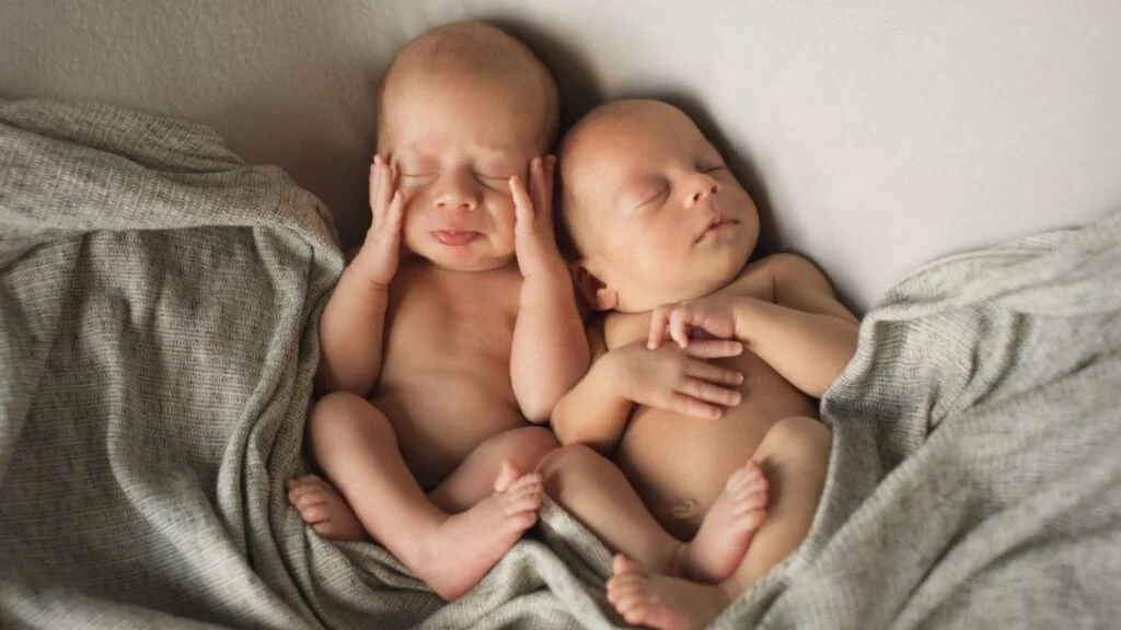 Newborn twins skin
