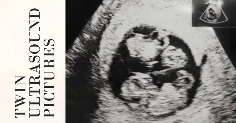 Twin ultrasound pictures